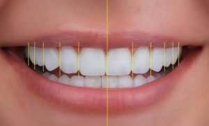 How Personalized Plans Deliver Better Cosmetic Dental Results